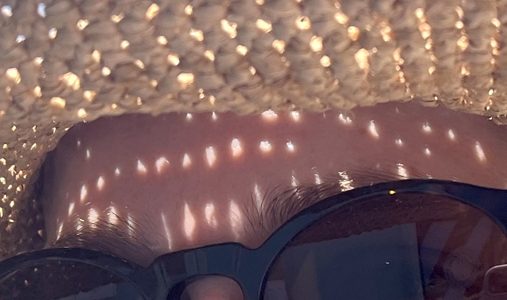 Speckles1